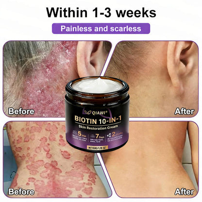 🔥Final 3 Hours 50% OFF - QIAWI® Biotin 10-in-1 Skin Restoration Cream