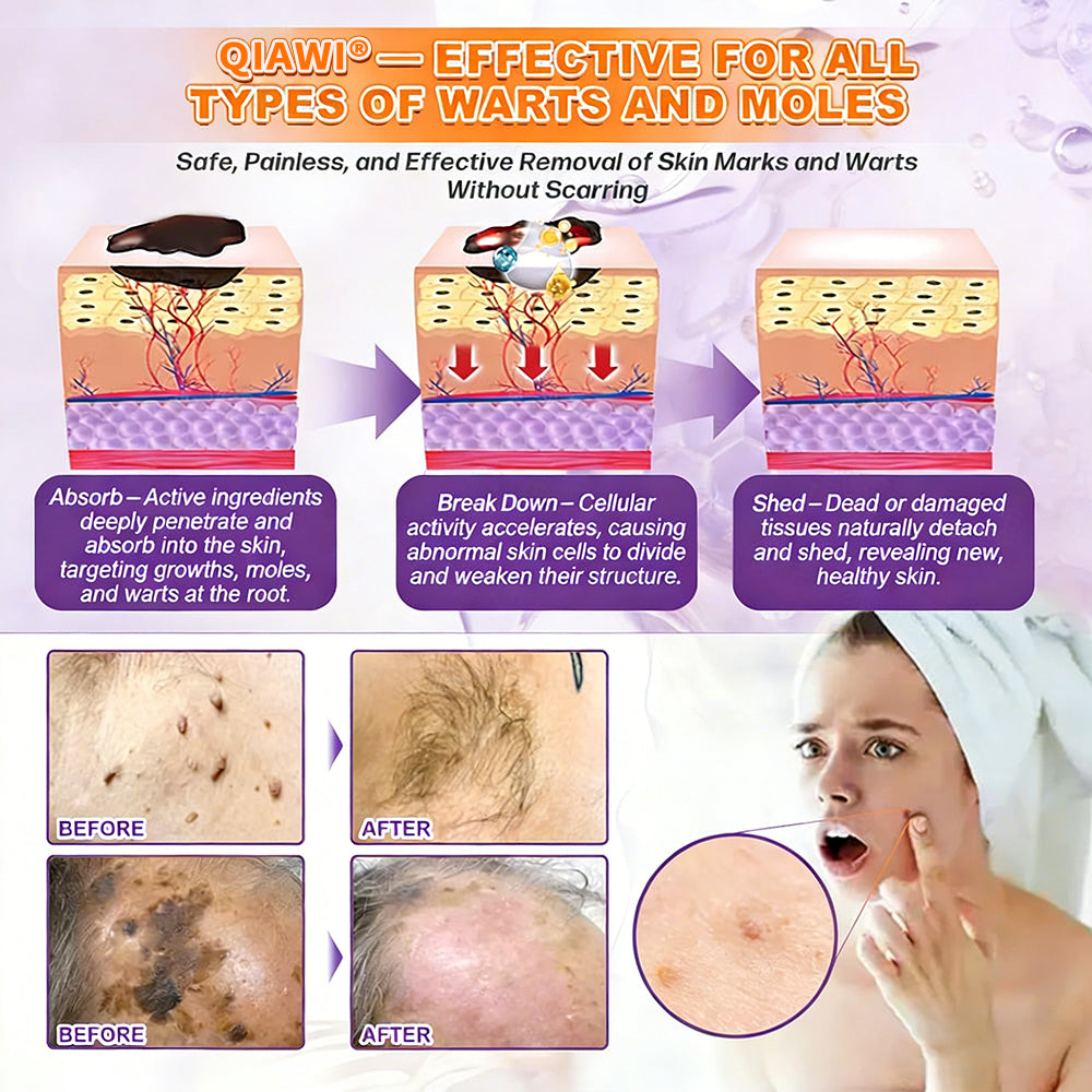 🔥Final 3 Hours 50% OFF - QIAWI® Biotin 10-in-1 Skin Restoration Cream