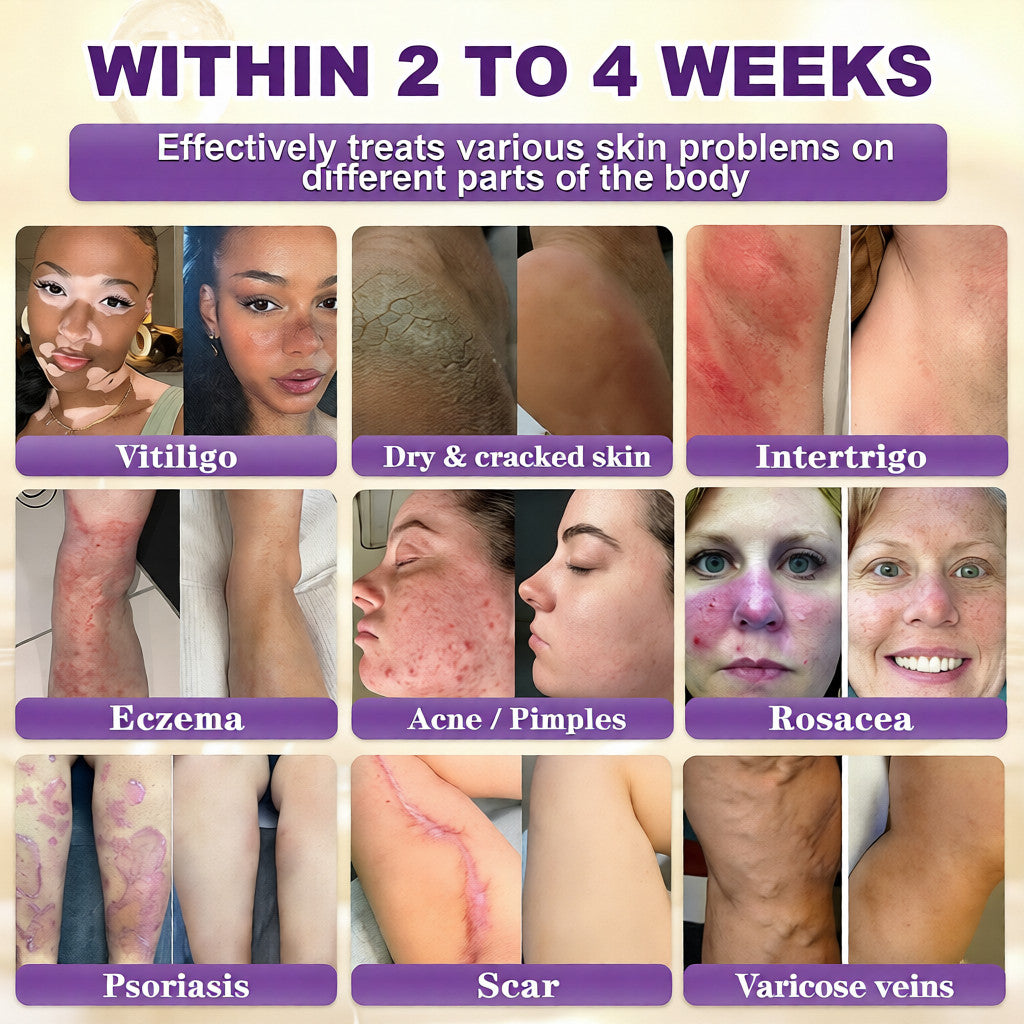 🔥Final 3 Hours 50% OFF - QIAWI® Biotin 10-in-1 Skin Restoration Cream