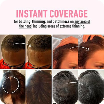 🎉Buy 1 Get 1 Free🎁 - StyleEdit Magic Root Touch Up