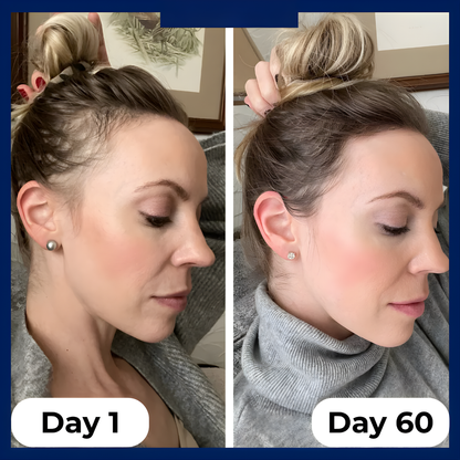 Regenx™ Hair Growth Serum Roll-on