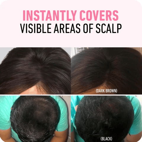 🎉Buy 1 Get 1 Free🎁 - StyleEdit Magic Root Touch Up
